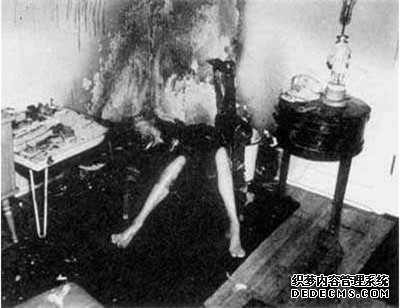 人体自燃之谜:人体自燃是真的吗 如何才会产生自燃现象