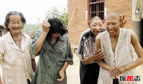 神农架猴娃之谜,百岁母亲养育三个猴娃(近亲联姻)