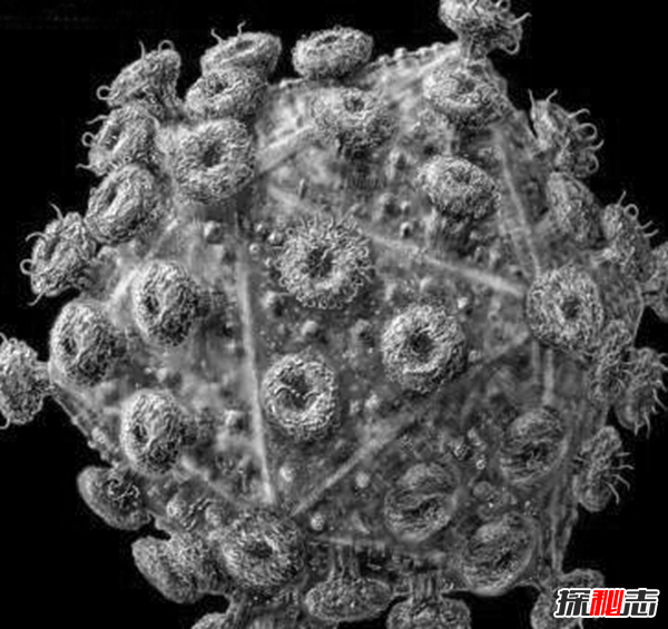 史上死亡人数最多的流行病:全世界近1亿人丧生(惨不忍睹)
