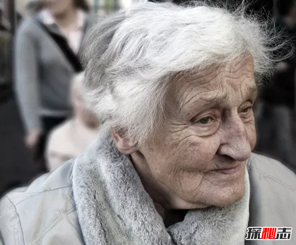 痴呆症死亡率最高的十个国家 美国排名第二,患者多为女性