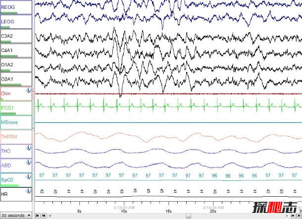 鬼压床是睡眠瘫痪?科学解释恐怖的睡眠瘫痪